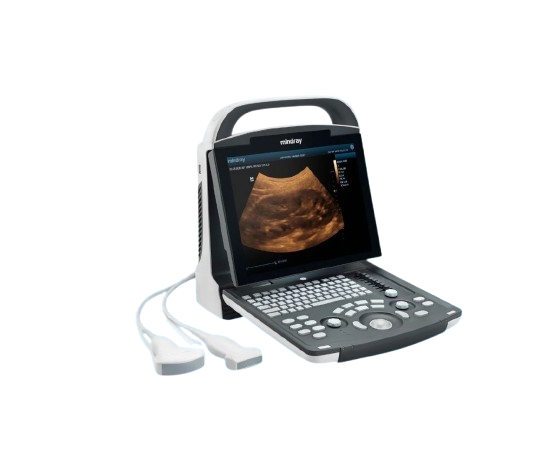 Ultrasonidos
