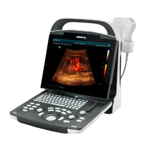 Ultrasonido Portátil Mindray DP-20 con Doppler Pulsado y Tecnología iClear