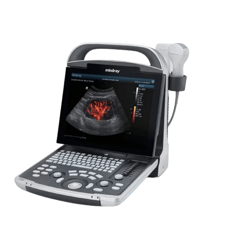 Ultrasonido Portátil Mindray DP30 con Power Doppler y PW Doppler para Uso Humano