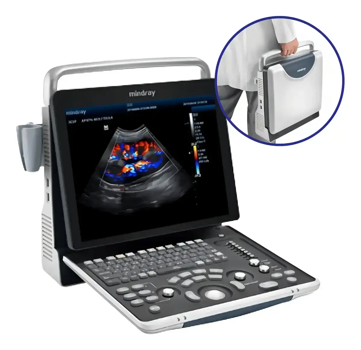 Ultrasonido Veterinario Portátil Color Doppler Mindray Z60VET para Clínicas y Hospitales Veterinarios - Imagen 1