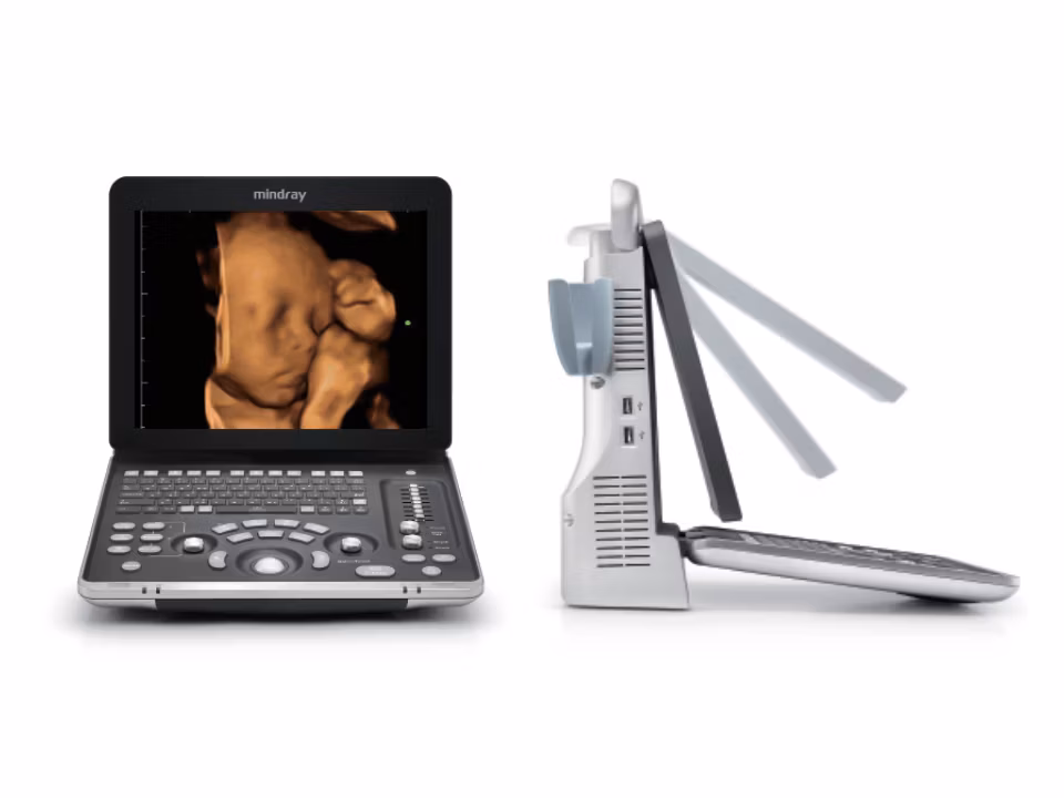 Ultrasonido Portátil Mindray Z60 Doppler Color con Transductores Convexo, Lineal y Endocavitario para Diagnóstico Médico - Imagen 1