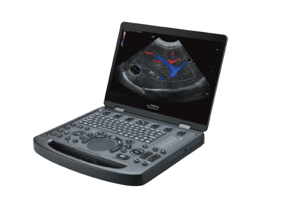 Ultrasonido Veterinario Portátil Mindray VETUSE5 con Inteligencia Artificial | Ecógrafo Profesional - Imagen 1